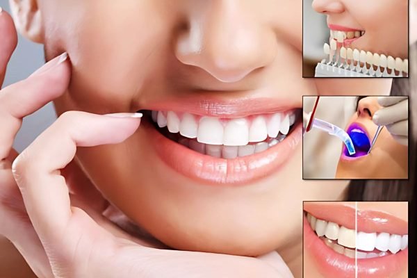 Best Dentist in Delhi - Cosmetic Dentistry